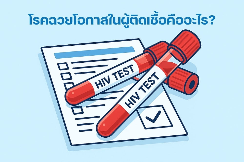โรคฉวยโอกาสในผู้อยู่ร่วมกับ HIV คืออะไร? อาการและการรักษา